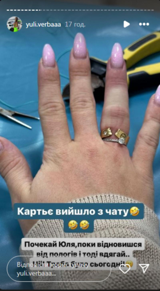 Відома блогерка потрапила до травмпункту через каблучку від Cartier