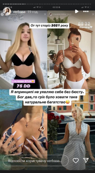 Блогерка Верба зробила підтяжку грудей через 8 місяців після пологів