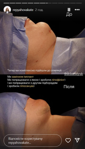 Дружина Павліка зробила четверту пластику та заявила, що вона буде останньою