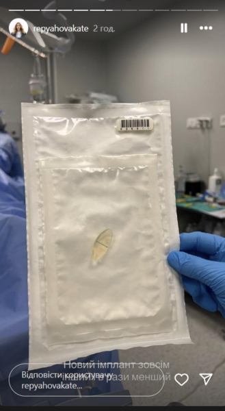 Дружина Павліка зробила четверту пластику та заявила, що вона буде останньою