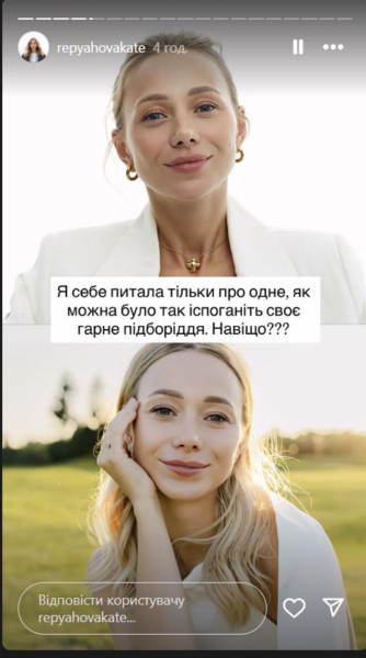 Репяхова розповіла про невдалу пластику і показала фото до та після