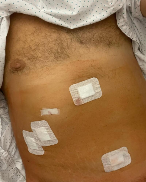 Потап заявив, що переніс складну операцію, і показав фото з лікарні