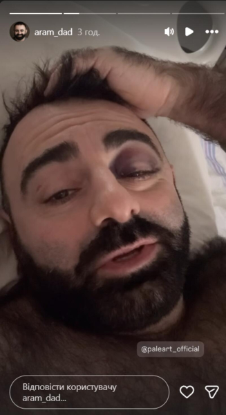 Відомий актор впав в оркестрову яму під час театральної вистави