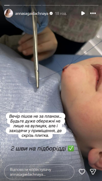 Сагайдачна показала сина у хірурга: що сталося із 6-річним Тимуром