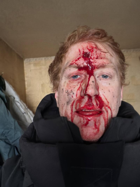 Ведучого Дениса Христова було поранено під час евакуації під Куп'янськом