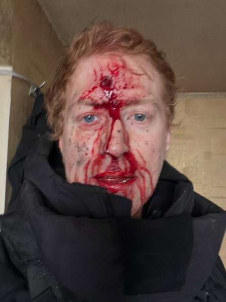 Ведучого Дениса Христова було поранено під час евакуації під Куп'янськом