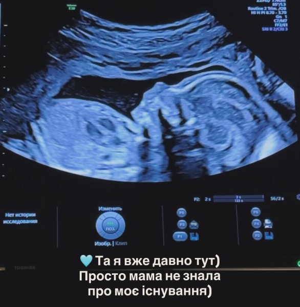 Сагайдачна зізналася, що лише на п'ятому місяці дізналася про третю вагітність